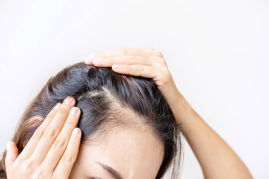 Najlepsze szampony na łuszczycę skóry głowy – przewodnik dla cierpiących
