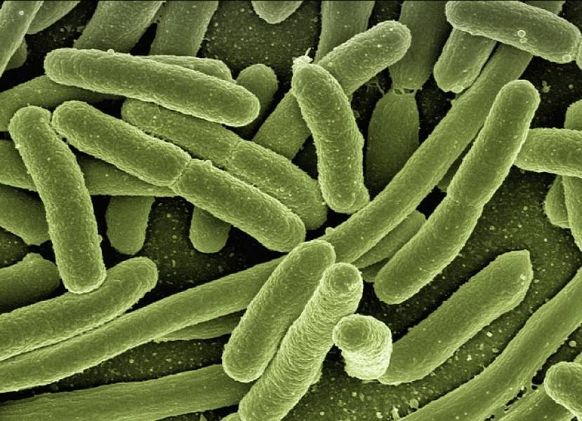 Jak pozbyć się złych bakterii z jelit?